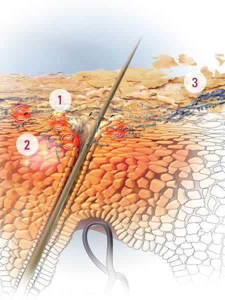 Eucerin: Scalp and hair problems| About greasy and dry dandruff